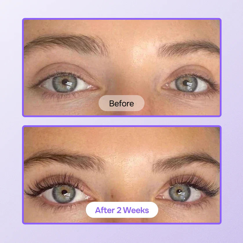 Aloria™ Eyelash Growth Serum